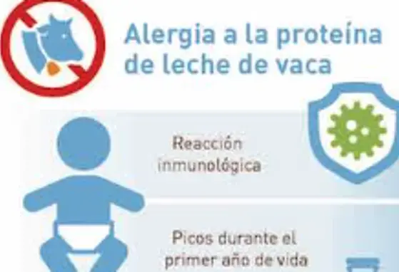 La alergia a la proteína de la la leche de vaca vs la intolerancia a la lactosa (infographics)