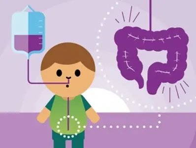 Módulo 10 – AFECCIONES DEL TRACTO GASTROINTESTINAL Módulo 10 – AFECCIONES DEL TRACTO GASTROINTESTINAL